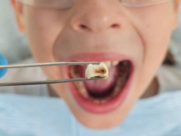 Best Emergency Dental Care for Abscessed Tooth in Arche, OK